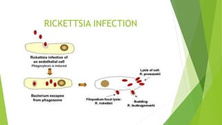 RICKETTSIA INFECTION
 