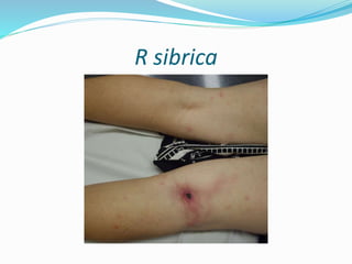 R sibrica
 