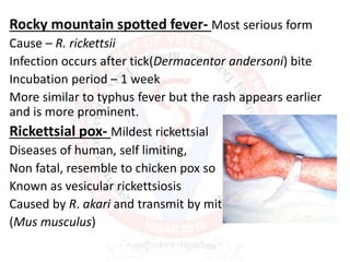 Rocky mountain spotted fever- Most serious form
Cause – R. rickettsii
Infection occurs after tick(Dermacentor andersoni) bite
Incubation period – 1 week
More similar to typhus fever but the rash appears earlier
and is more prominent.
Rickettsial pox- Mildest rickettsial
Diseases of human, self limiting,
Non fatal, resemble to chicken pox so
Known as vesicular rickettsiosis
Caused by R. akari and transmit by mite
(Mus musculus)
 