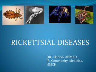 DR . SHAAN AHMED
JR ,Community Medicine,
NMCH
RICKETTSIAL DISEASES
 