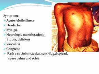 Symptoms:
 Acute febrile illness
 Headache
 Myalgia
 Neurologic manifestations-
Stupor, delirium
 Vasculitis
 Gangrene
 Rash : 40-80% macular, centrifugal spread,
spare palms and soles
 
