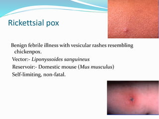 Rickettsial pox
Benign febrile illness with vesicular rashes resembling
chickenpox.
Vector:- Liponyssoides sanguineus
Reservoir:- Domestic mouse (Mus musculus)
Self-limiting, non-fatal.
 