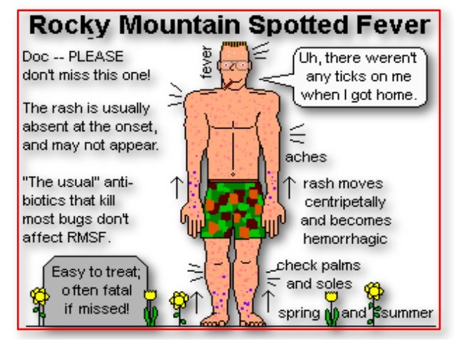 rocky mountain spotted fever Rocky mountain spotted fever overview rocky mountain spotted fever (rmsf) can be a potentially severe or fatal disease caused. rocky mountain spotted fever Rocky mountain spotted fever overview rocky mountain spotted fever (rmsf) can be a potentially severe or fatal disease caused.