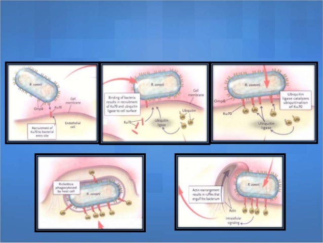 Rickettsial diseases