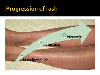 Necrotic
          petechiae


Maculopapular
 