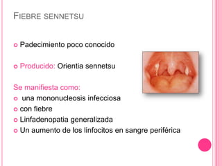 FIEBRE SENNETSU


   Padecimiento poco conocido

   Producido: Orientia sennetsu

Se manifiesta como:
 una mononucleosis infecciosa

 con fiebre

 Linfadenopatia generalizada

 Un aumento de los linfocitos en sangre periférica
 