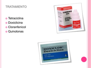 TRATAMIENTO


 Tetraciclina
 Doxiclicina

 Cloranfenicol

 Quinolonas
 