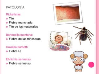 PATOLOGÍA

Rickettsias:
 Tifo
 Fiebre manchada
 Tifo de los matorrales


Bartonella quintana:
 Fiebre de las trincheras


Coxiella burnetti:
 Fiebre Q


Ehrlichia sennetsu:
 Fiebre sennetsu
 