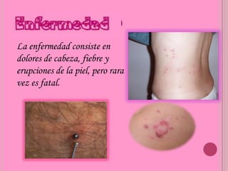 La enfermedad consiste en
dolores de cabeza, fiebre y
erupciones de la piel, pero rara
vez es fatal.
 