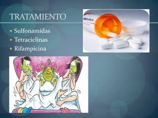 TRATAMIENTO
 Sulfonamidas
 Tetraciclinas
 Rifampicina
 