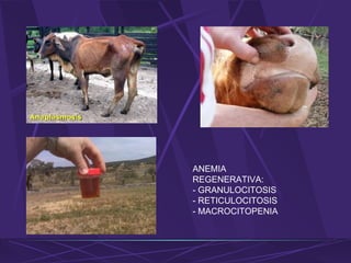 ANEMIA
REGENERATIVA:
- GRANULOCITOSIS
- RETICULOCITOSIS
- MACROCITOPENIA
 