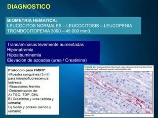 DIAGNOSTICO
BIOMETRIA HEMATICA:
LEUCOCITOS NORMALES – LEUCOCITOSIS – LEUCOPENIA
TROMBOCITOPENIA 3000 – 45 000 mm3.
Transaminasas levemente aumentadas
Hiponatremia
Hipoalbuminemia
Elevación de azoadas (urea / Creatinina)
 