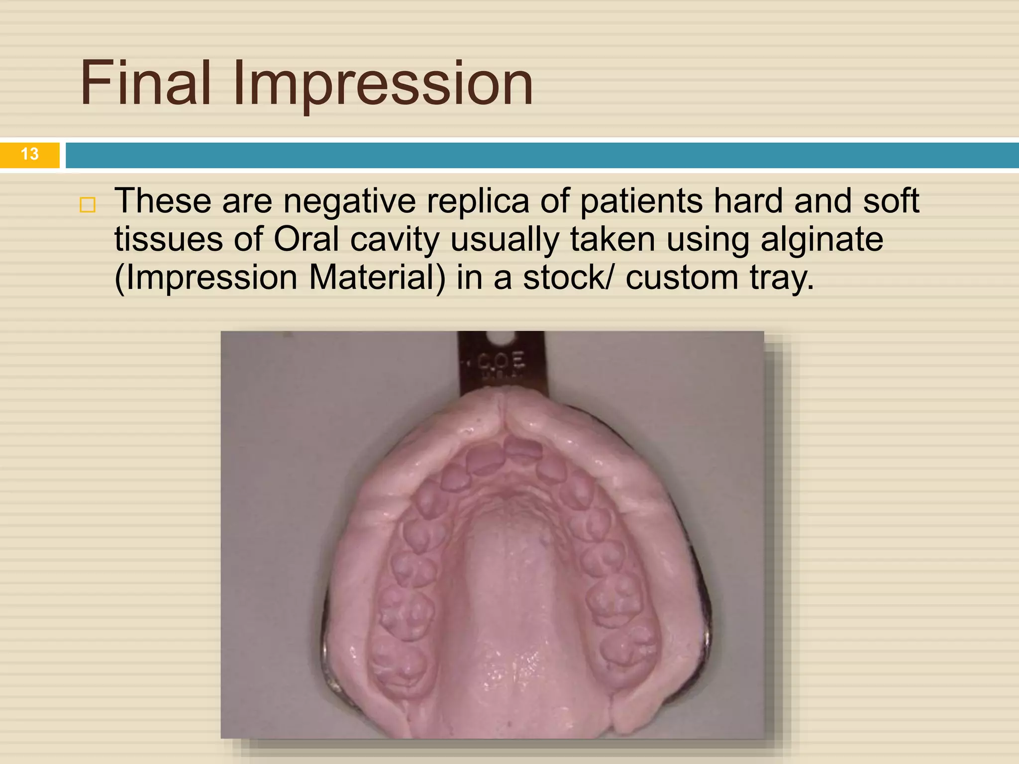 Final Impression
 These are negative replica of patients hard and soft
tissues of Oral cavity usually taken using alginate
(Impression Material) in a stock/ custom tray.
13
 
