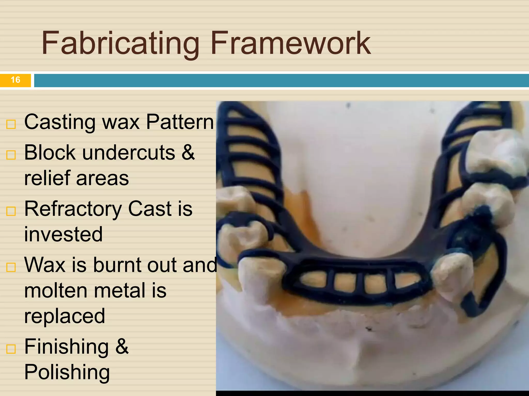 Fabricating Framework
 Casting wax Pattern
 Block undercuts &
relief areas
 Refractory Cast is
invested
 Wax is burnt out and
molten metal is
replaced
 Finishing &
Polishing
16
 
