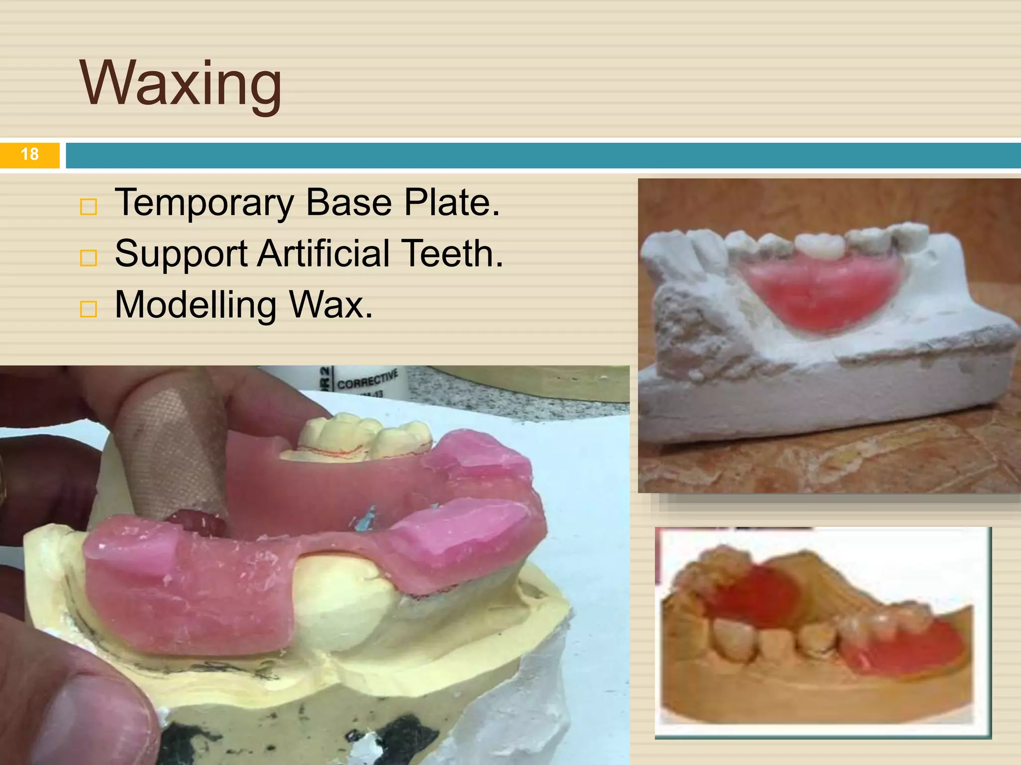 Waxing
 Temporary Base Plate.
 Support Artificial Teeth.
 Modelling Wax.
18
 