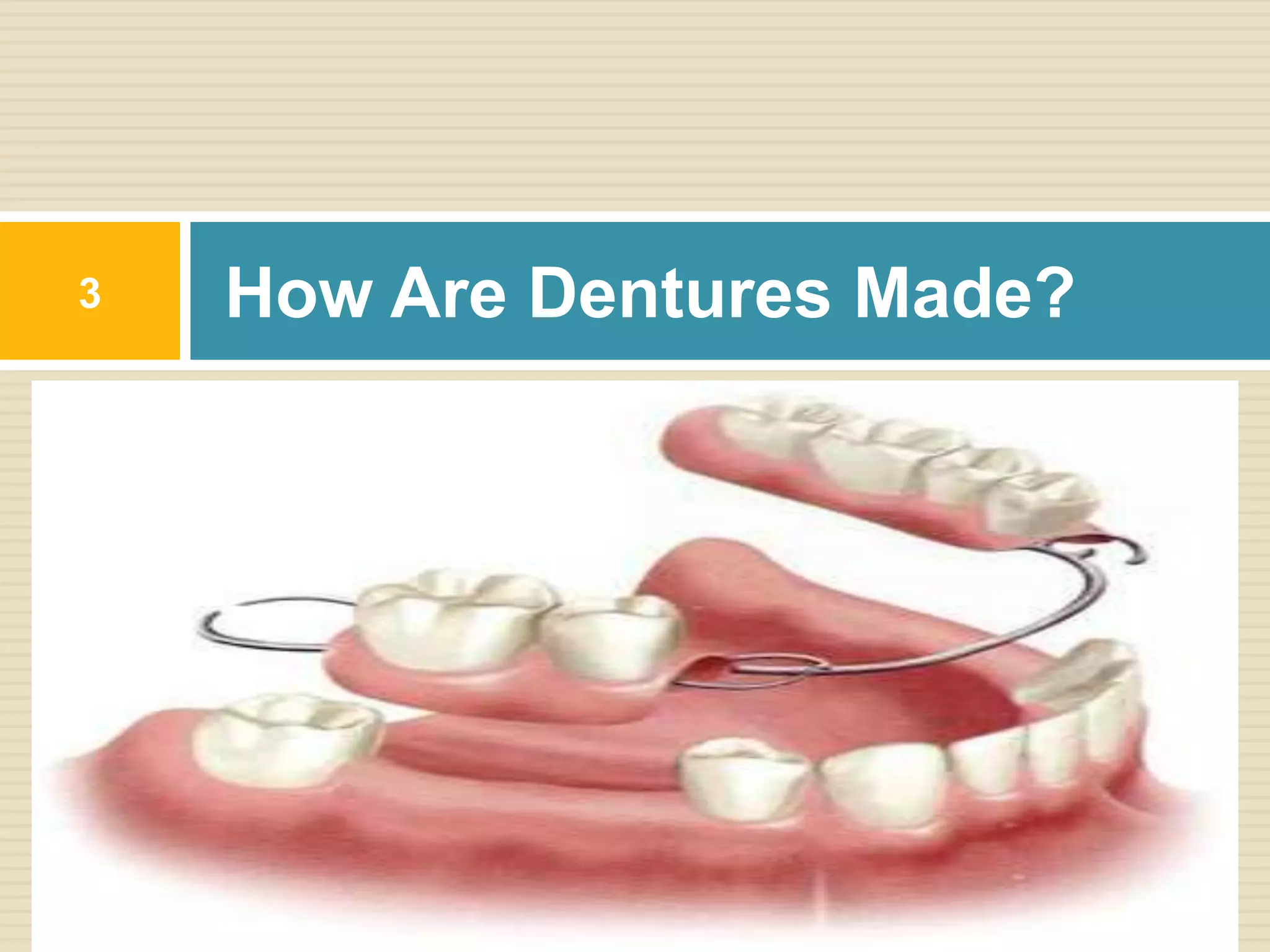 How Are Dentures Made?3
 