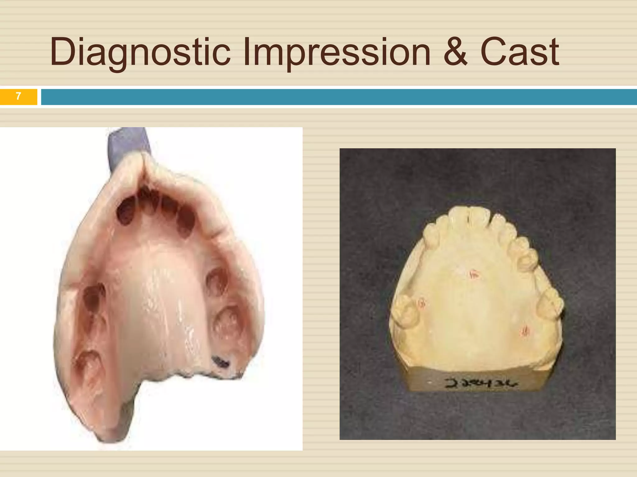 Diagnostic Impression & Cast
7
 