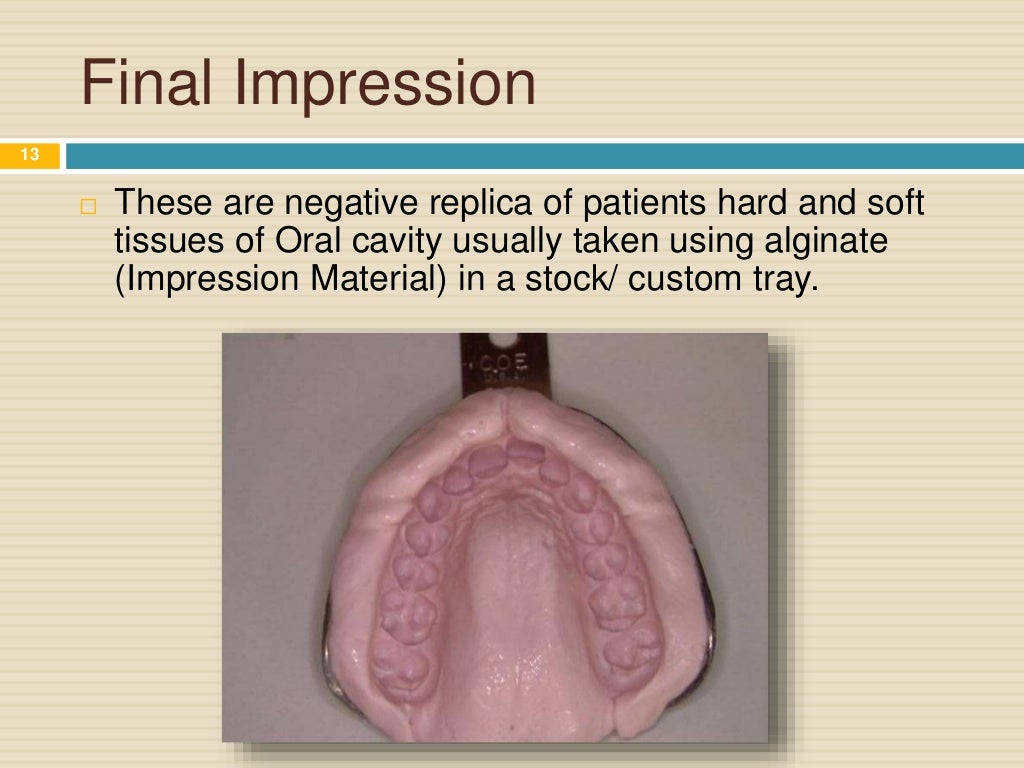 Steps of Fabrication of Removable Partial Denture