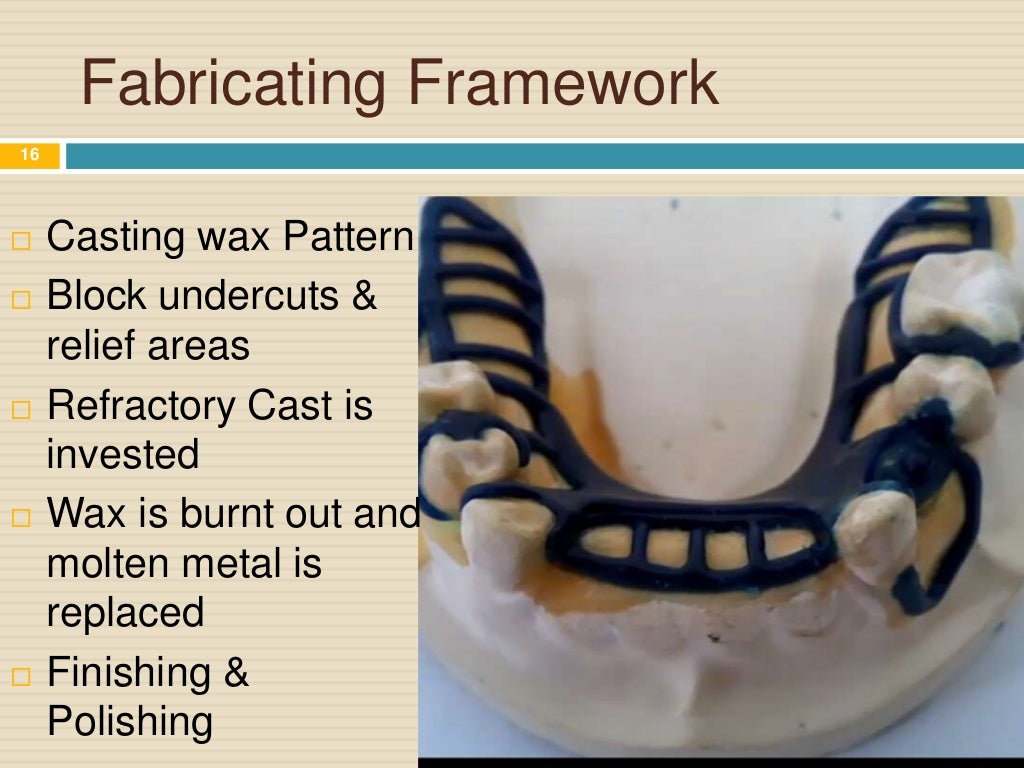 Steps of Fabrication of Removable Partial Denture