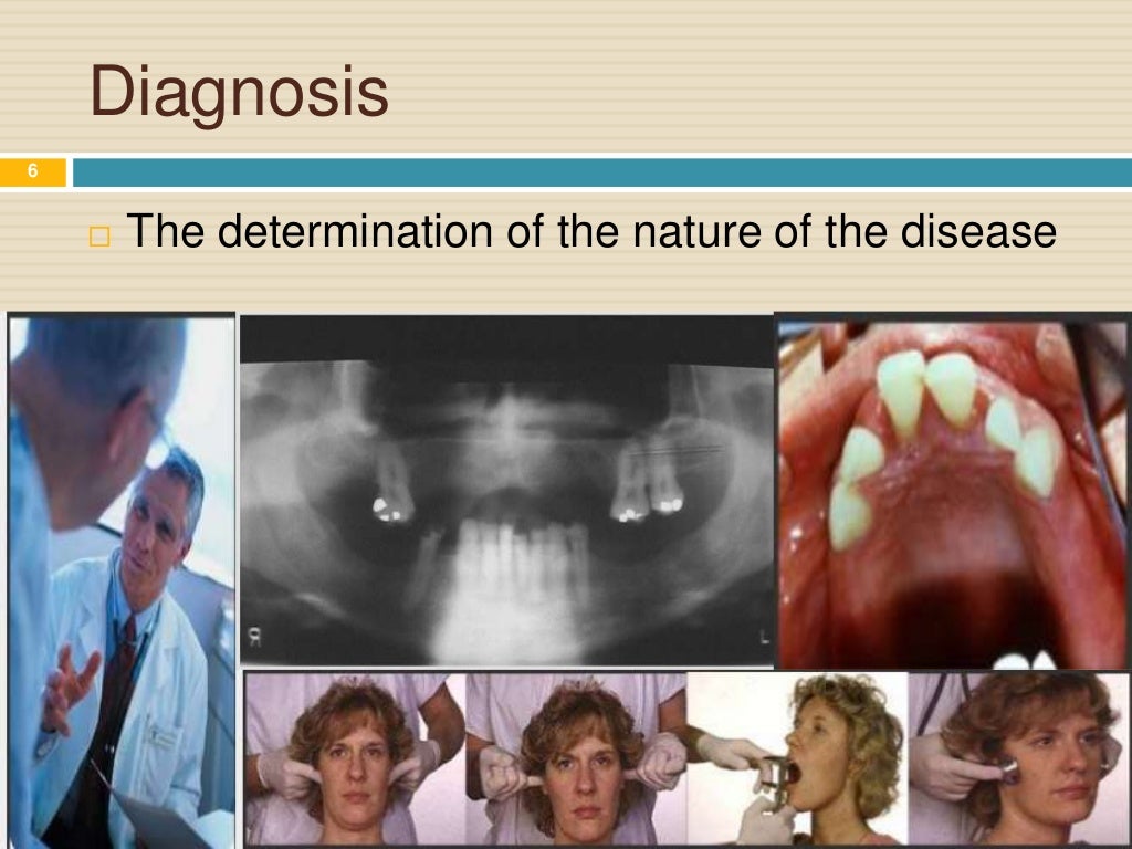 Steps of Fabrication of Removable Partial Denture