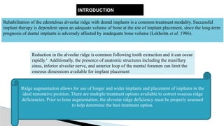 RIDGE AUGMENTATION - Rationale, Techniques.pptx