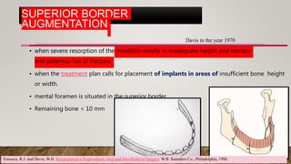 SUPERIOR BORDER
AUGMENTATION
INDICATED
• when severe resorption of the mandible results in inadequate height and contour
and potential risk of fracture
• when the treatment plan calls for placement of implants in areas of insufficient bone height
or width.
• mental foramen is situated in the superior border
• Remaining bone < 10 mm
Davis in the year 1970
Fonseca, R.J. and Davis, W.H. Reconstructive Preprosthetic Oral and Maxillofacial Surgery. W.B. Saunders Co., Philadelphia, 1986
 