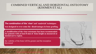 COMBINED VERTICALAND HORIZONTAL OSTEOTOMY
(KOOMEN ET AL)
The combination of the ‘visor’ and ‘sandwich’ techniques
was designed to over come the disadvantages in bone grafting.
A modification of the visor osteotomy has been recommended
for patients with at least 8 mm of bone height as measured at
mental nerve region.
the viability of the bone will be greater and the resorption
decreased
Stoelinga, P.J.W. Preprosthetic Reconstructive Surgery.
 