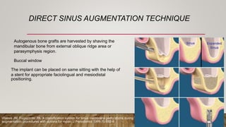 DIRECT SINUS AUGMENTATION TECHNIQUE
Autogenous bone grafts are harvested by shaving the
mandibular bone from external oblique ridge area or
parasymphysis region.
Buccal window
The implant can be placed on same sitting with the help of
a stent for appropriate faciolingual and mesiodistal
positioning.
Vlassis JM, Fugazzotto PA. A classification system for sinus membrane perforations during
augmentation procedures with options for repair. J Periodontol 1999;70:692-9
 