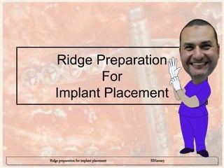 Ridge preparation for implant placement ElHawary
Ridge Preparation
For
Implant Placement
 