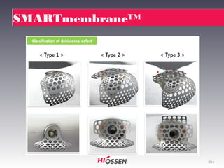 SMARTmembrane™

204

 