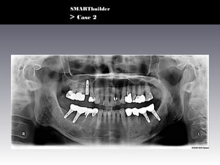 SMARTbuilder

> Case 2

 