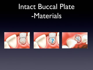 Intact Buccal Plate
-Materials

 