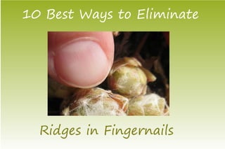 10 Best Ways to Eliminate




  Ridges in Fingernails
 