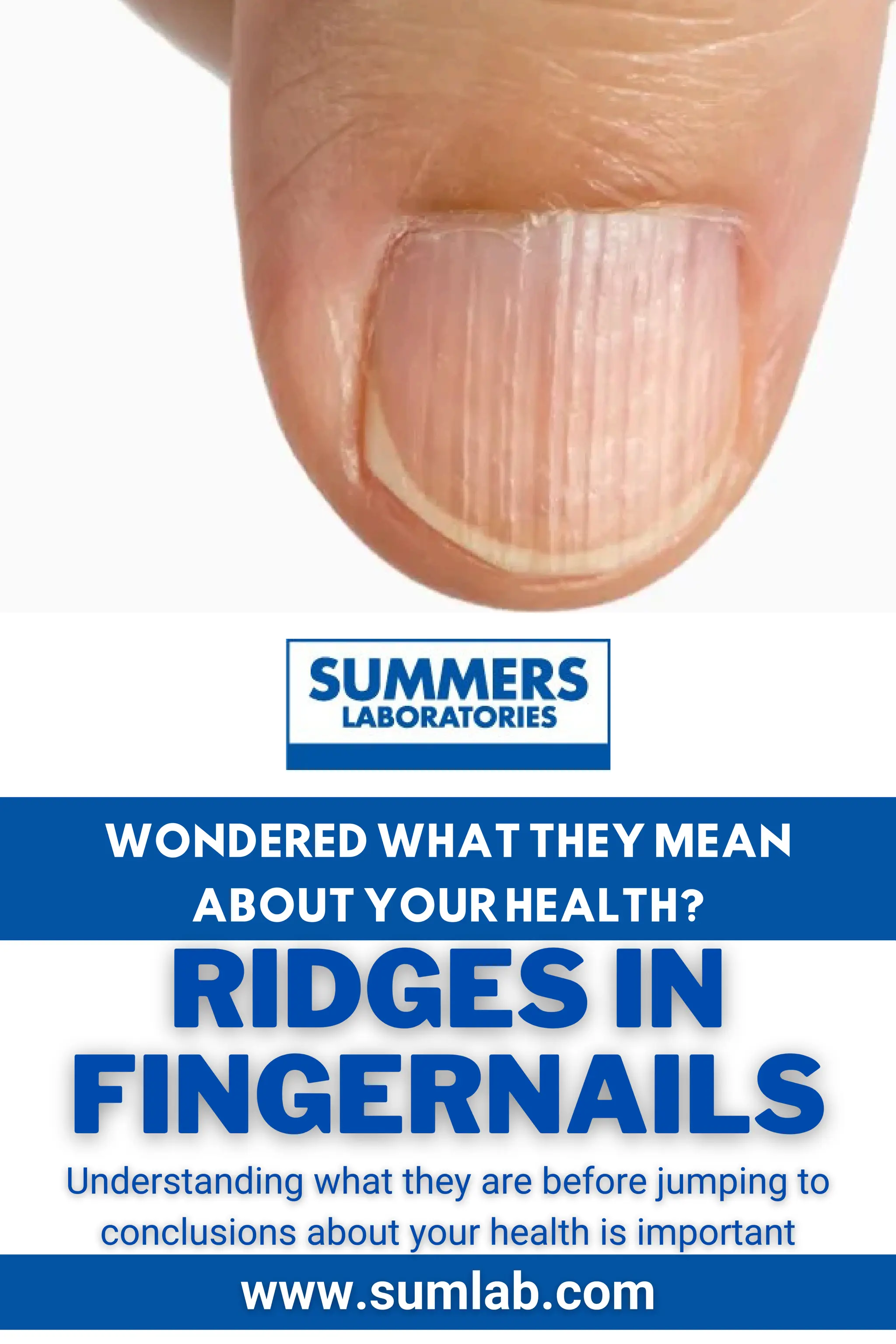 How can you get rid of ridges in your fingernails naturally? PDF