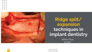 1
Ridge split/
expansion
techniques in
implant dentistry
Nishu Priya
III PGT
 