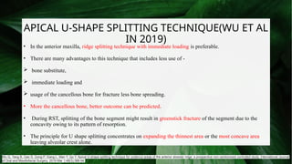 Ridge Split Techniques in Prosthodontics: Enhancing Alveolar Ridge for ...