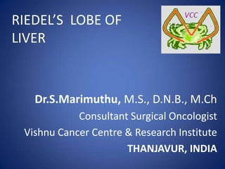 Dr.S.Marimuthu, M.S., D.N.B., M.Ch
Consultant Surgical Oncologist
Vishnu Cancer Centre & Research Institute
THANJAVUR, INDIA
RIEDEL’S LOBE OF
LIVER
 
