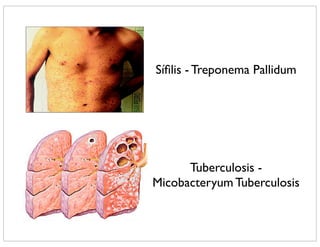 Síﬁlis - Treponema Pallidum




      Tuberculosis -
Micobacteryum Tuberculosis
 