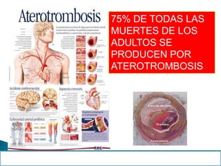 75% DE TODAS LAS
MUERTES DE LOS
ADULTOS SE
PRODUCEN POR
ATEROTROMBOSIS
 