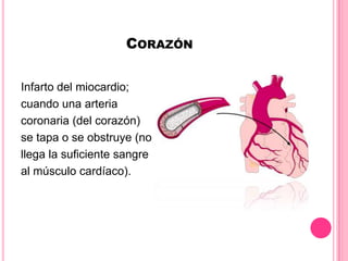 CORAZÓN
Infarto del miocardio;
cuando una arteria
coronaria (del corazón)
se tapa o se obstruye (no
llega la suficiente sangre
al músculo cardíaco).
 