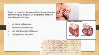 Según la New York American Heart Association los
elementos para efectuar un diagnostico cardiaco
completo comprenden:
1. La causa subyacente
2. Anomalías anatómicas
3. Las alteraciones fisiológicas
4. Discapacidad funcional
 