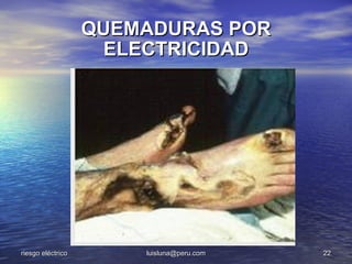 QUEMADURAS POR
                    ELECTRICIDAD




riesgo eléctrico       luisluna@peru.com   22
 