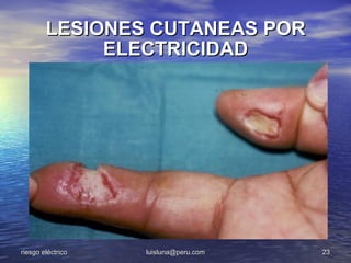 LESIONES CUTANEAS POR
             ELECTRICIDAD




riesgo eléctrico   luisluna@peru.com   23
 