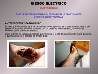 RIESGO ELECTRICO ELECTROCUCION CASO DE ELECTROCUCION DE UN OPERARIO DE LA CONSTRUCCION LESIONES CARACTERISTICAS ANTECEDENTES Y CASO CLÍNICO: El caso que nos ocupa es el de una adulto joven, operario de la construcción, que al des- plazar un andamio metálico, contacta con un cable de media tensión, actuando el andamio como conductor eléctrico. En el examen de las ropas destaca quemadura del tejido del guante de la mano izquierda y quemaduras en el calzado de ambos pies. 