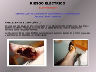 RIESGO ELECTRICO
                                    ELECTROCUCION


           CASO DE ELECTROCUCION DE UN OPERARIO DE LA CONSTRUCCION
                              LESIONES CARACTERISTICAS


ANTECEDENTES Y CASO CLÍNICO:
El caso que nos ocupa es el de una adulto joven, operario de la construcción, que al des-
plazar un andamio metálico, contacta con un cable de media tensión, actuando el
andamio como conductor eléctrico.
En el examen de las ropas destaca quemadura del tejido del guante de la mano izquierda
y quemaduras en el calzado de ambos pies.
 