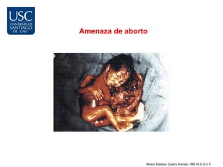 Amenaza de aborto




                Alvaro Esteban Castro Aranda - MD M.S.O U.V
 