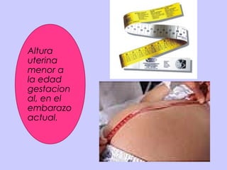 Altura
uterina
menor a
la edad
gestacion
al, en el
embarazo
actual.
 