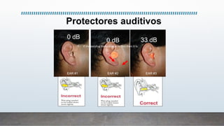 0 dB
0 dB 33 dB
EAR #1 EAR #2 EAR #3
If the earplug looks similar to this then it is:
Protectores auditivos
 