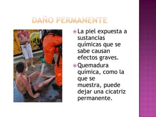  La piel expuesta a
  sustancias
  químicas que se
  sabe causan
  efectos graves.
 Quemadura
  química, como la
  que se
  muestra, puede
  dejar una cicatriz
  permanente.
 