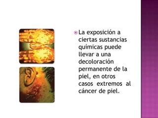  Laexposición a
 ciertas sustancias
 químicas puede
 llevar a una
 decoloración
 permanente de la
 piel, en otros
 casos extremos al
 cáncer de piel.
 